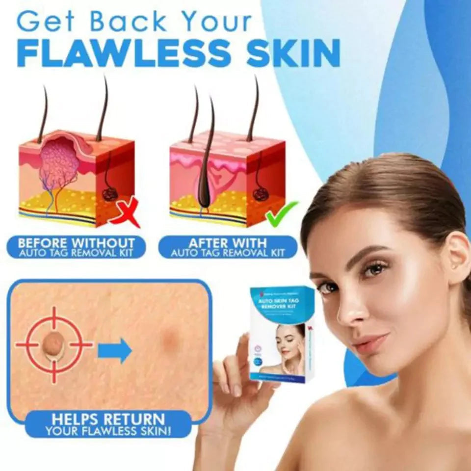 Kit quitamarcas cutáneas suave Aero Tag — sistema doméstico de 6 etapas