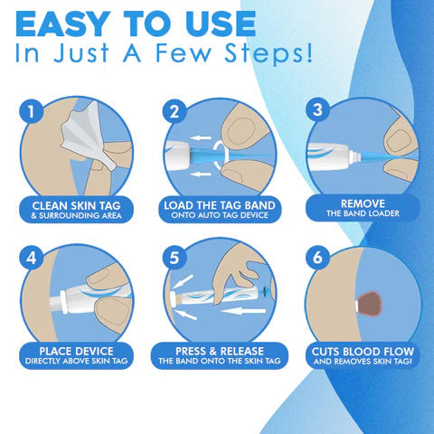 Kit quitamarcas cutáneas suave Aero Tag — sistema doméstico de 6 etapas