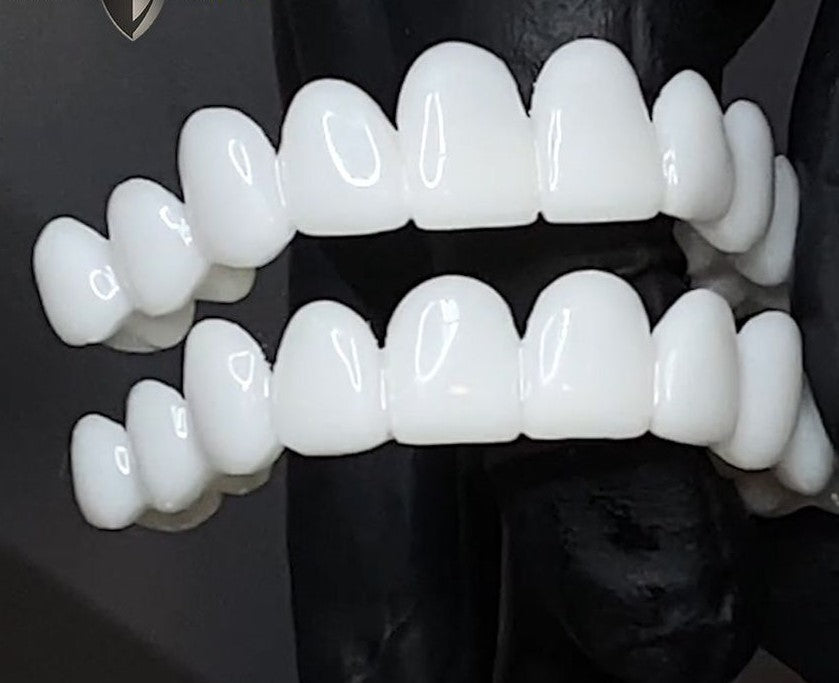 DentAlign påknäppbara tandöverdrag – flexibelt skydd med anpassad passform