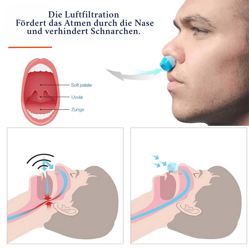 BreezeGuard Snore Reduction Air Filter System — Snore Prevention, Air Purifying Device