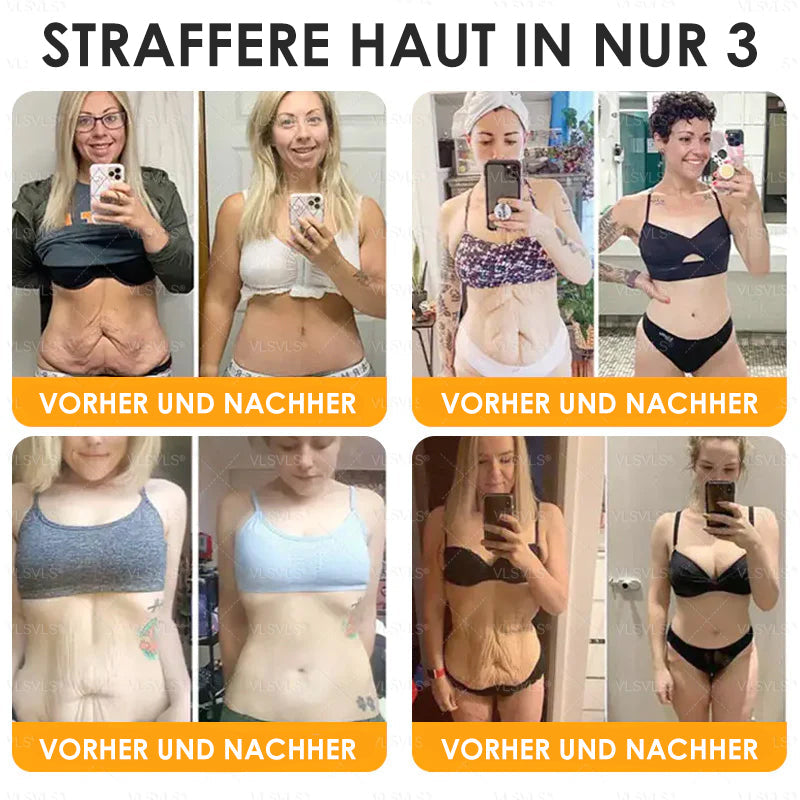 Anti-agingkräm för hudläkning och förnyelse med bipetidformel | ka-mostore