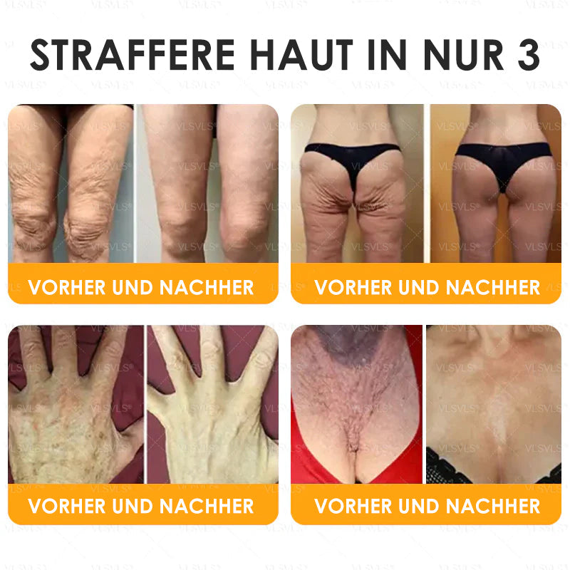 Anti-agingkräm för hudläkning och förnyelse med bipetidformel | ka-mostore