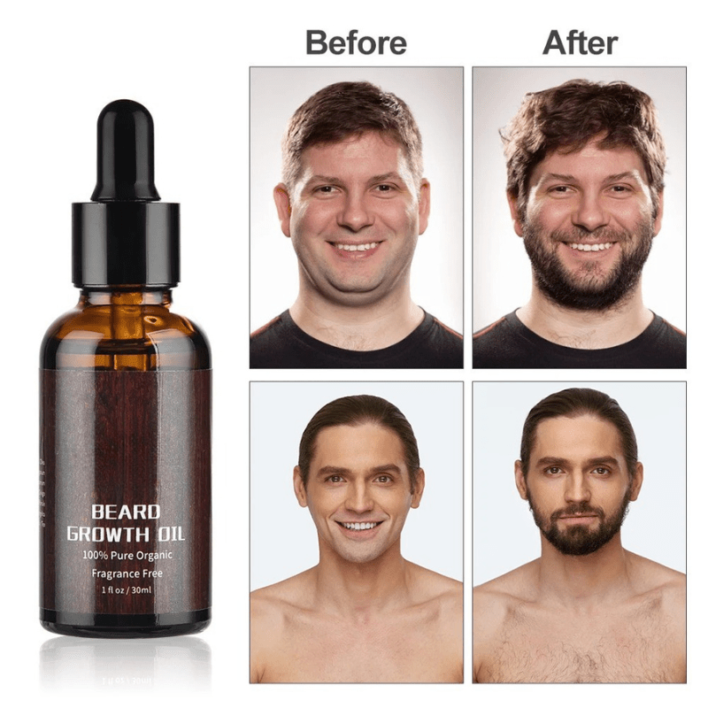 Set BeardBloom pentru creștere — Set complet pentru terapia cu microace
