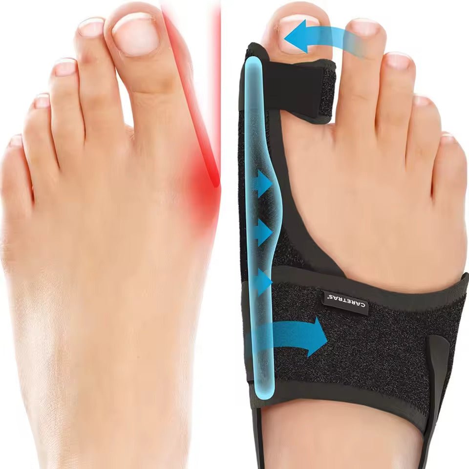 Night Toe Splint With Adjustable Fit - Ergonomic Toe Positioning For Left Or Right Foot