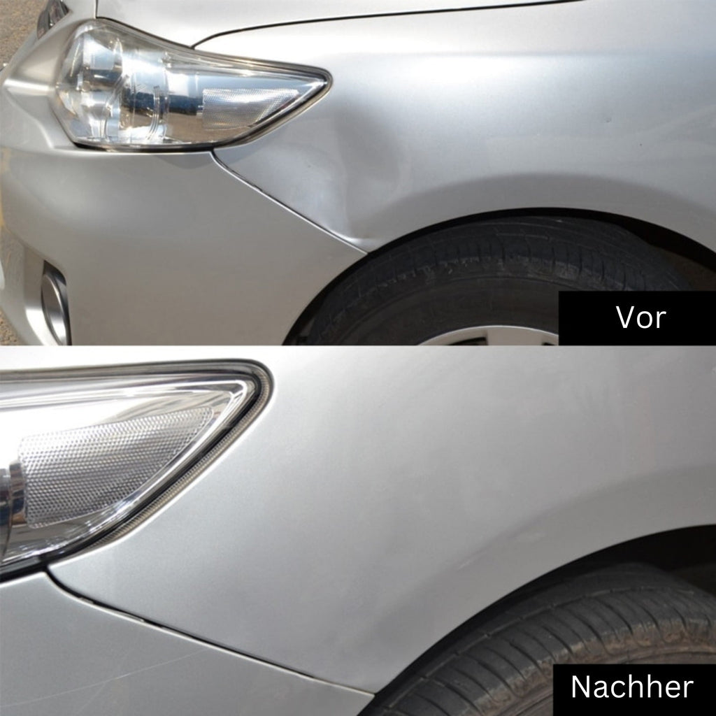 DellenMeister Car Dent Repair Tool — Paint-Safe Dent and Ding Remover
