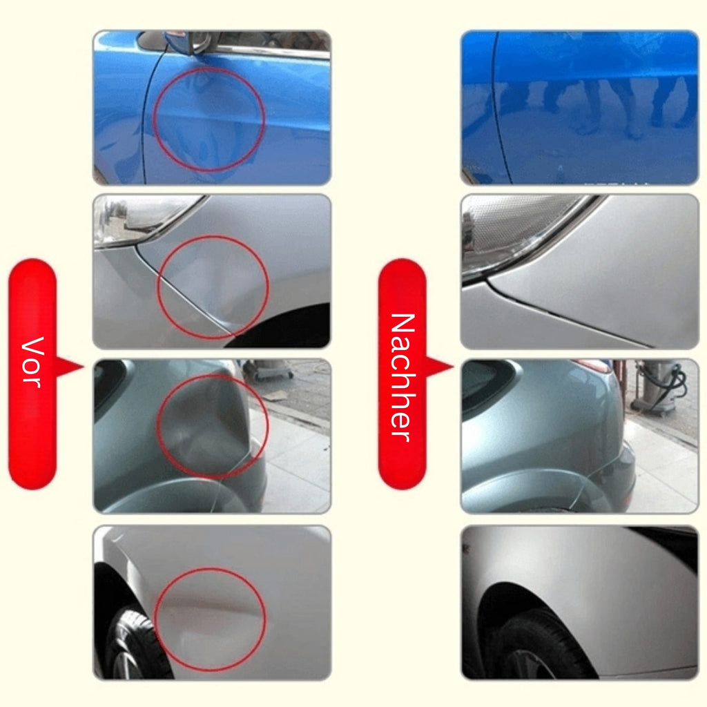 DellenMeister Car Dent Repair Tool — Paint-Safe Dent and Ding Remover