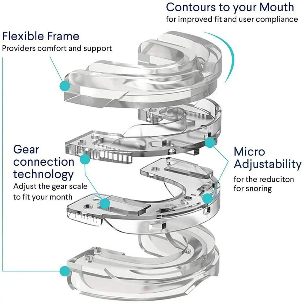 QuietGuard Pro 降鼾口腔矫治器——下颌前移装置