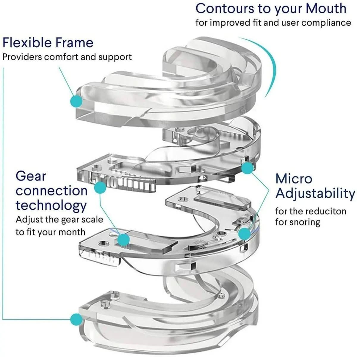 QuietGuard Pro 降鼾口腔矫治器——下颌前移装置
