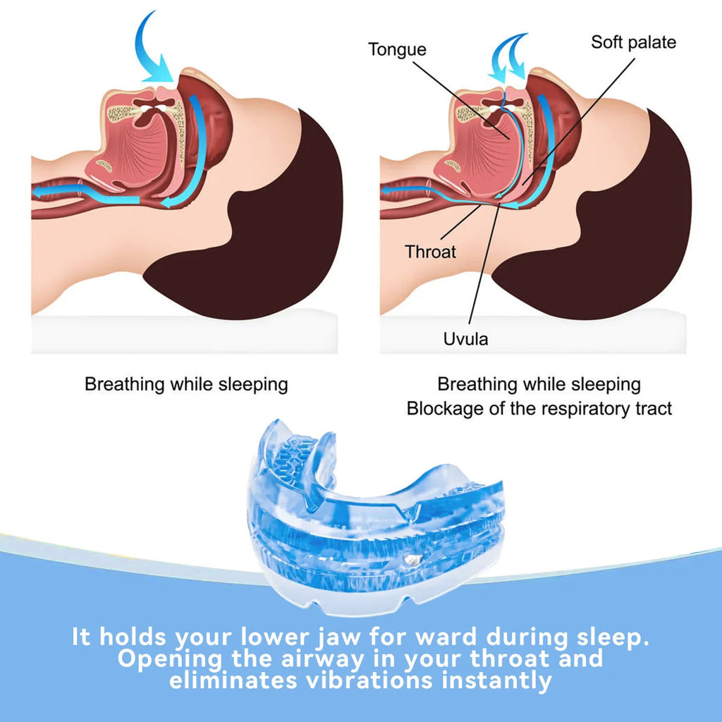 Adjustable Anti-Snoring Mouthguard Made of BPA-Free Material | Ka-mostore
