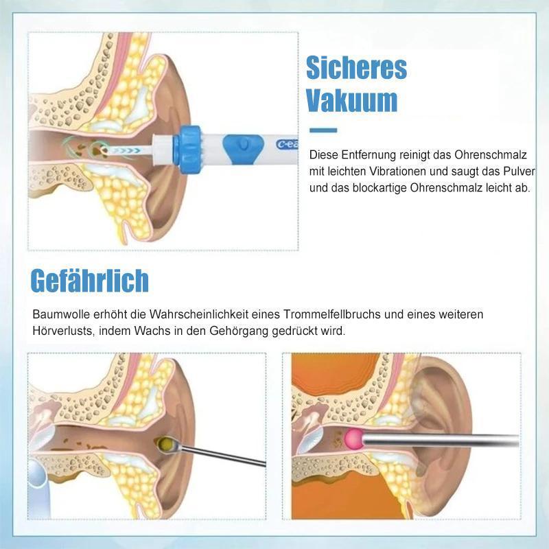 Ear Wax Remover Vacuum | Ka-mostore
