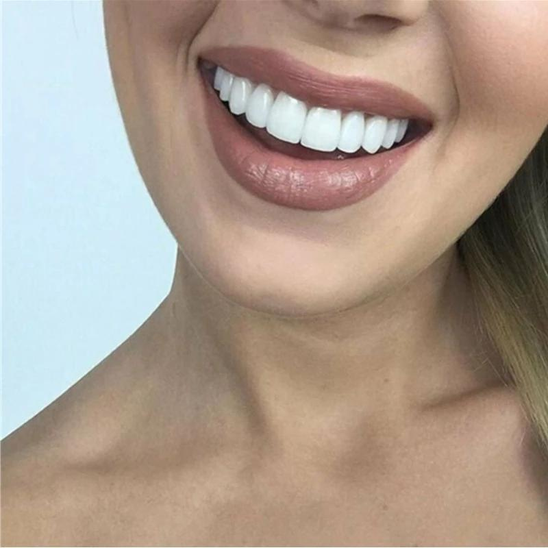 Cosmetische facings voor een zelfverzekerde glimlach | Ka-mostore