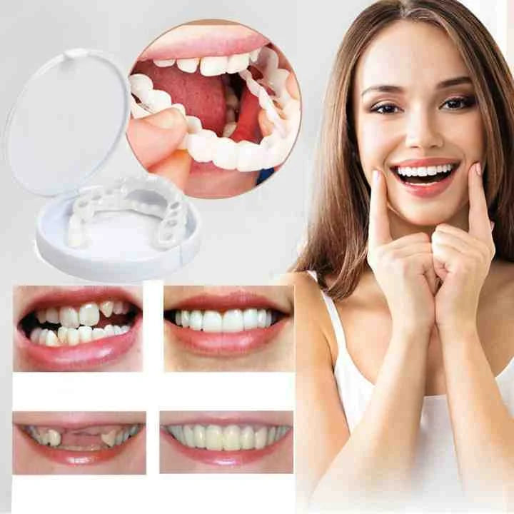 Cosmetische facings voor een zelfverzekerde glimlach | Ka-mostore