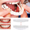On Smile Veneers (Upper and Lower Jaw Included) | Ka-mostore