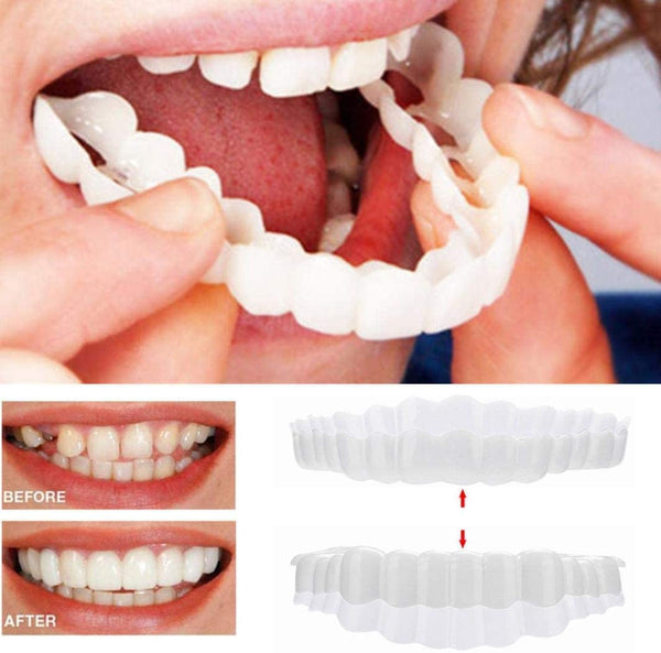 On Smile Veneers (Upper and Lower Jaw Included) | Ka-mostore