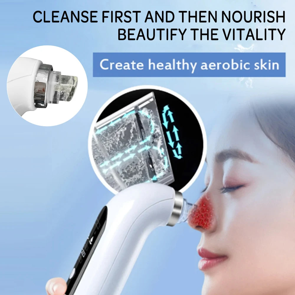 Facial Pore Cleanser Vacuum - Gentle Blackhead Extraction Tool | Ka-mostore