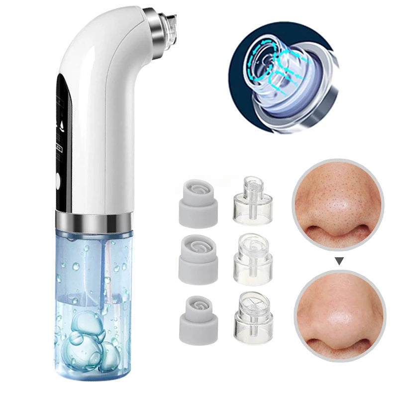 Facial Pore Cleanser Vacuum - Gentle Blackhead Extraction Tool | Ka-mostore
