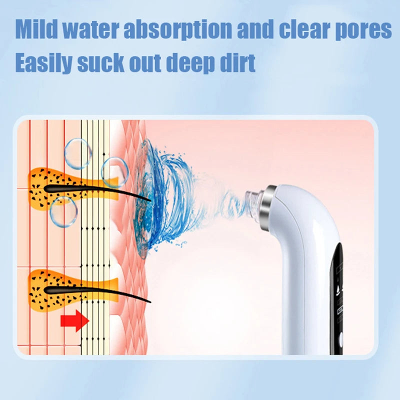 Facial Pore Cleanser Vacuum - Gentle Blackhead Extraction Tool | Ka-mostore