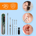 Set de nettoyage des oreilles OhrFrisch — aspiration douce, design ergonomique, embouts réutilisables