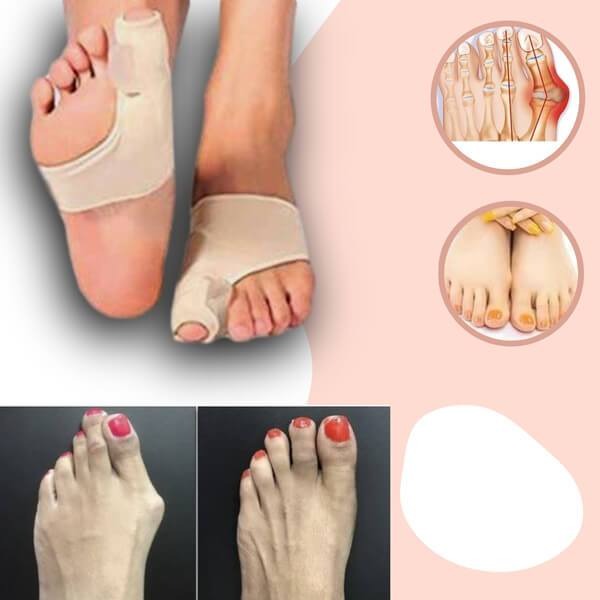 Corector pentru monturi, pentru ameliorarea durerii cauzate de hallux valgus | Ka-mostore
