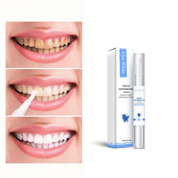 Quick Teeth Whitening for a Radiant Smile | Ka-mostore
