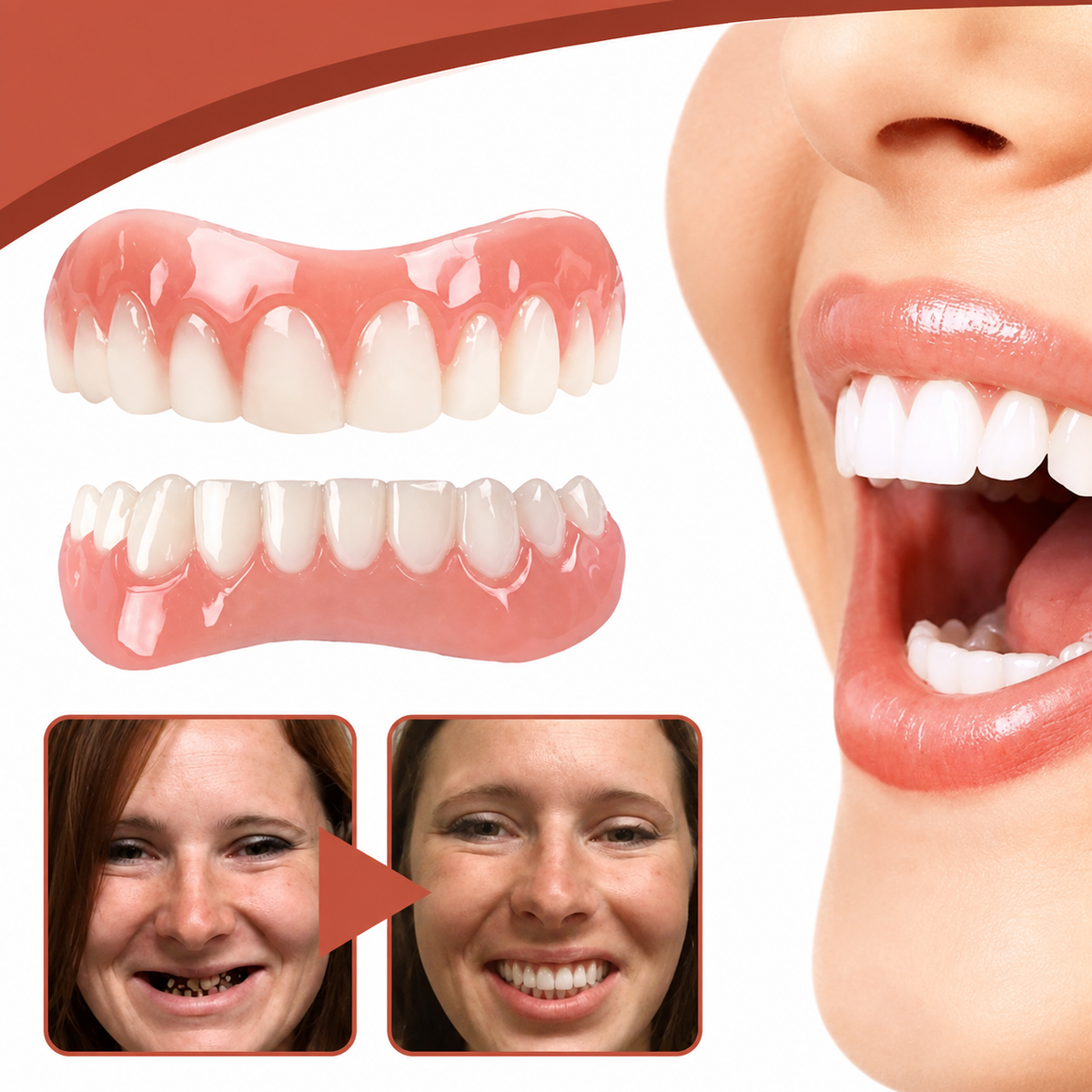 Silicone Dental Prosthetics — Biocompatible Material, Natural Look, Flexible Base