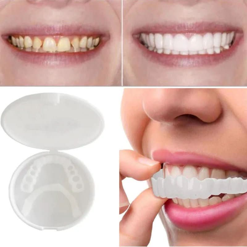 SNAPFIT SMILE – Tooth restoration for a perfect smile without a dentist | Ka-mostore