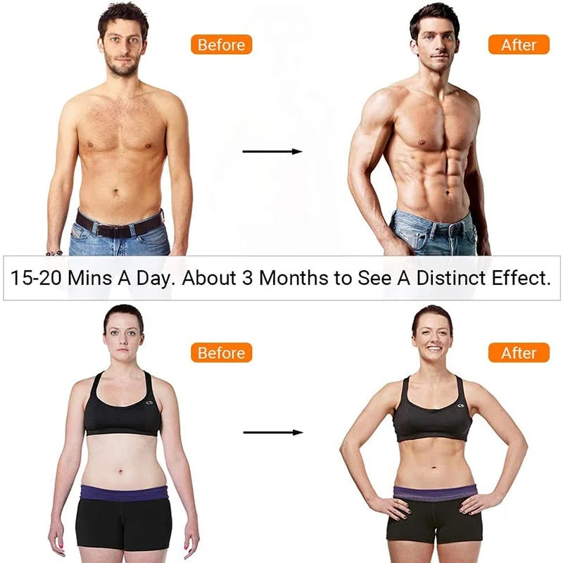 X ABS-Stimulator | Ka-mostore